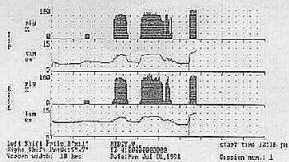 Rigiscan chart